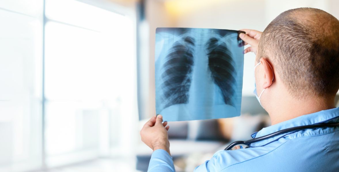 What is pulmonary embolism? Symptoms & Cause