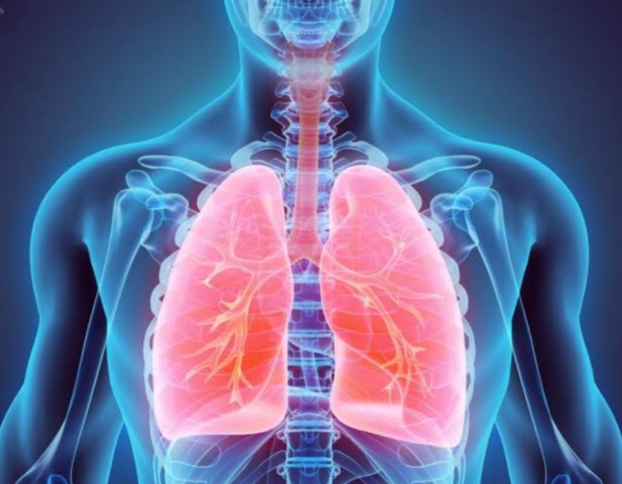 Non-cardiogenic Pulmonary Edema (NCPE)